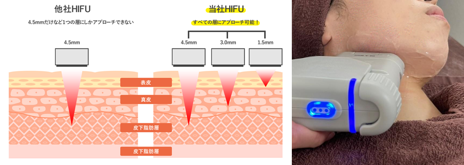 新しいコラーゲンを増やす